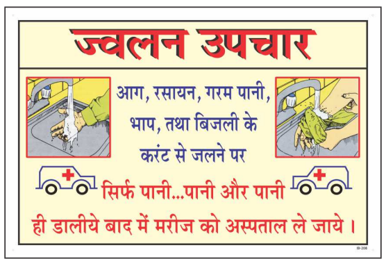 Hindi Burn First Aid Instruction Sign with treatment illustrations by Safe Cure